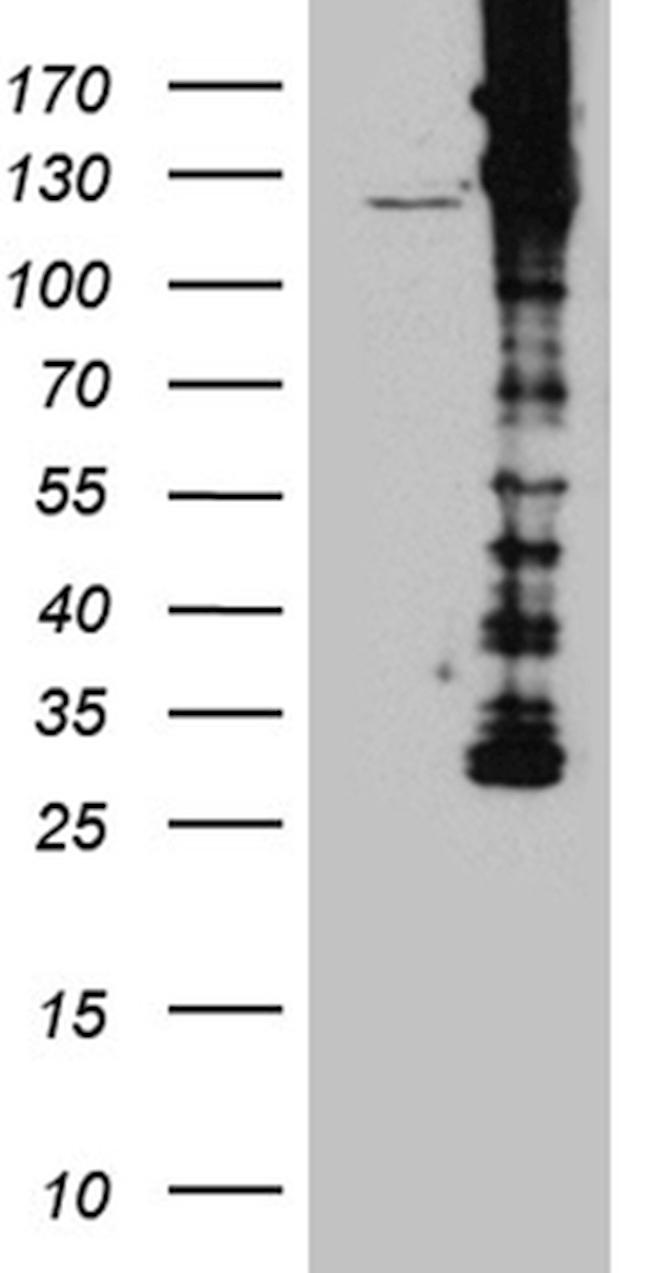 DBN1 Antibody in Western Blot (WB)