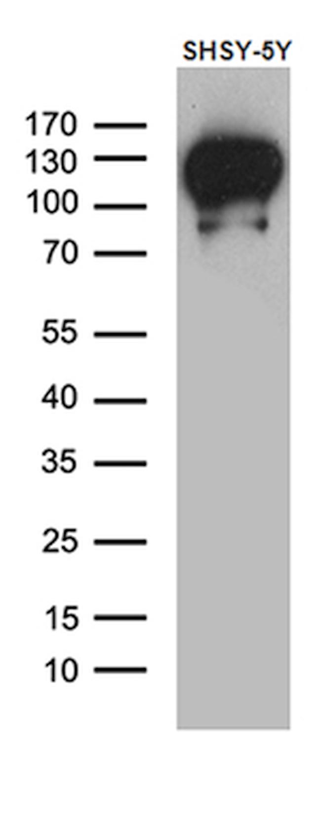 DBN1 Antibody in Western Blot (WB)