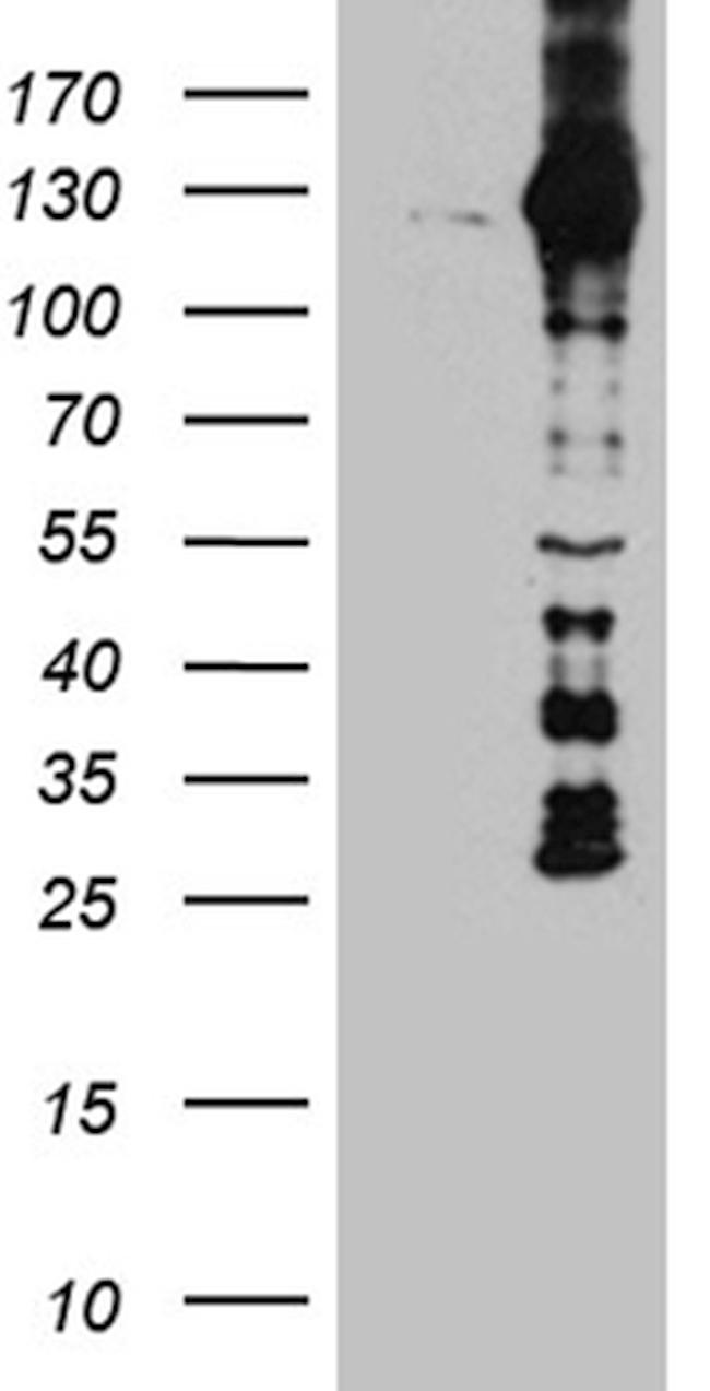 DBN1 Antibody in Western Blot (WB)