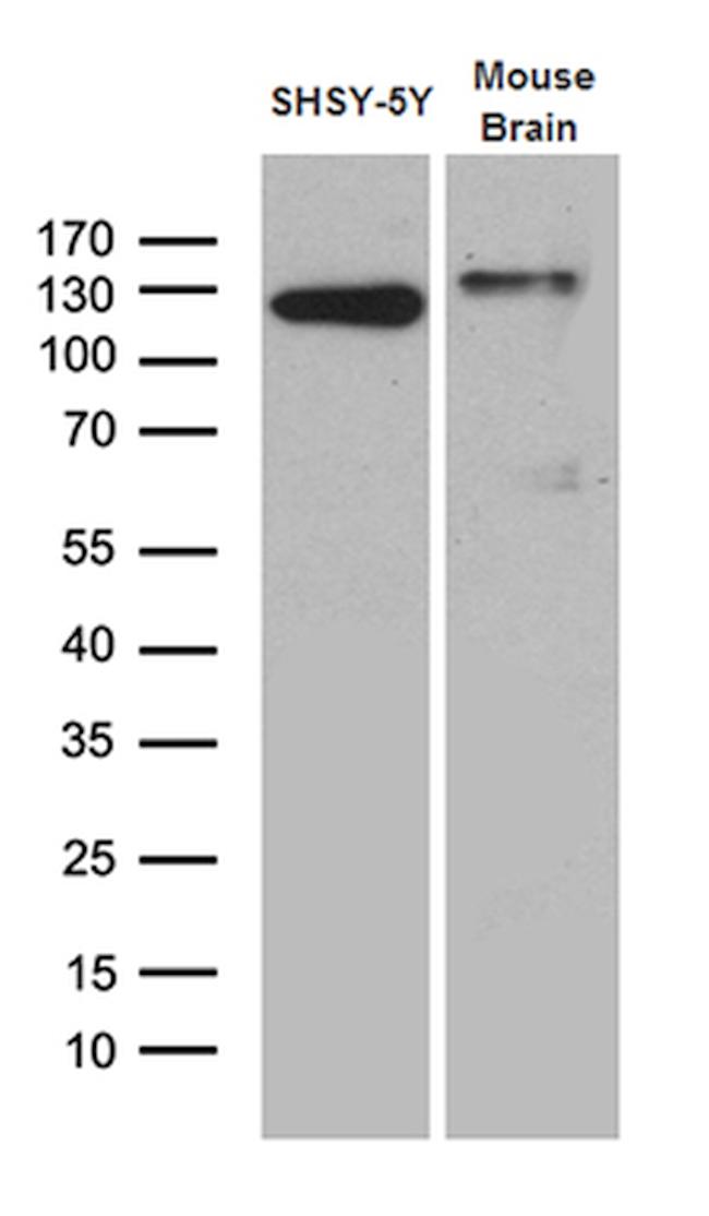 DBN1 Antibody in Western Blot (WB)