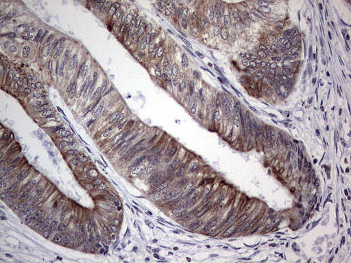 DBNL Antibody in Immunohistochemistry (Paraffin) (IHC (P))