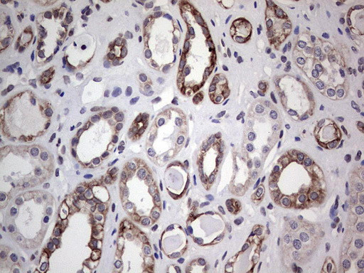 DBNL Antibody in Immunohistochemistry (Paraffin) (IHC (P))