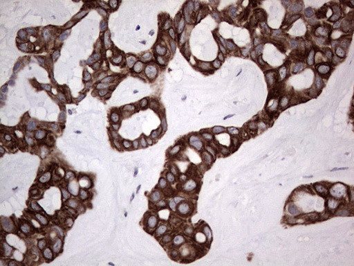 DBNL Antibody in Immunohistochemistry (Paraffin) (IHC (P))