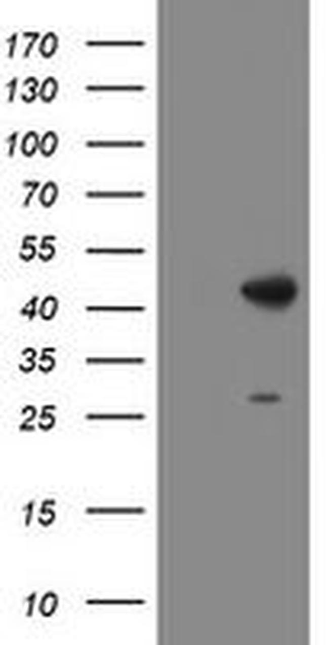 DBT Antibody in Western Blot (WB)