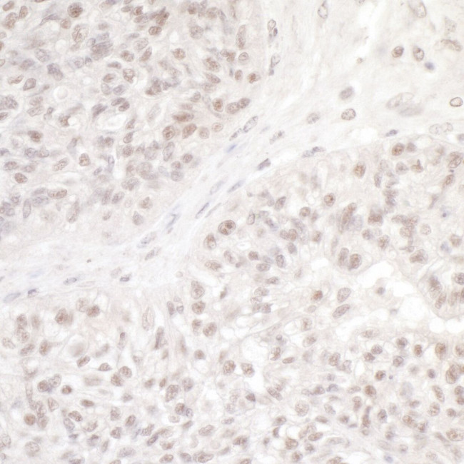 DC8 Antibody in Immunohistochemistry (IHC)