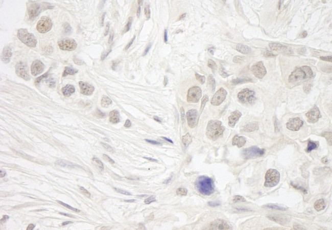 DC8 Antibody in Immunohistochemistry (IHC)