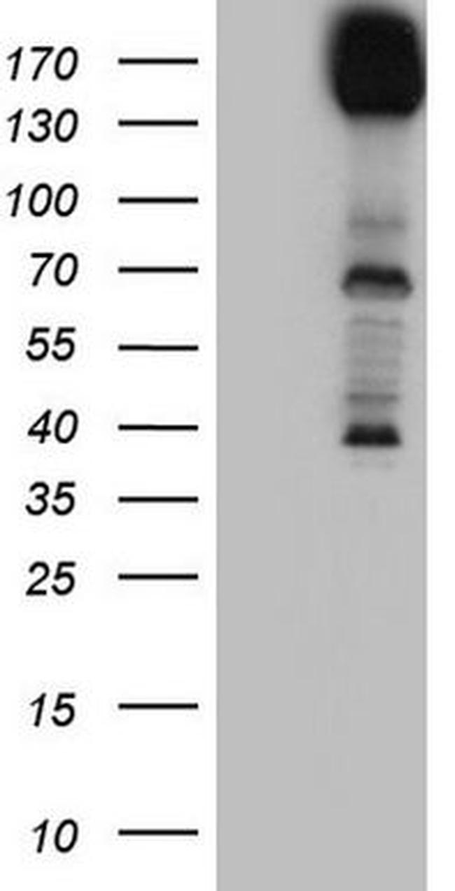 DCC Antibody in Western Blot (WB)