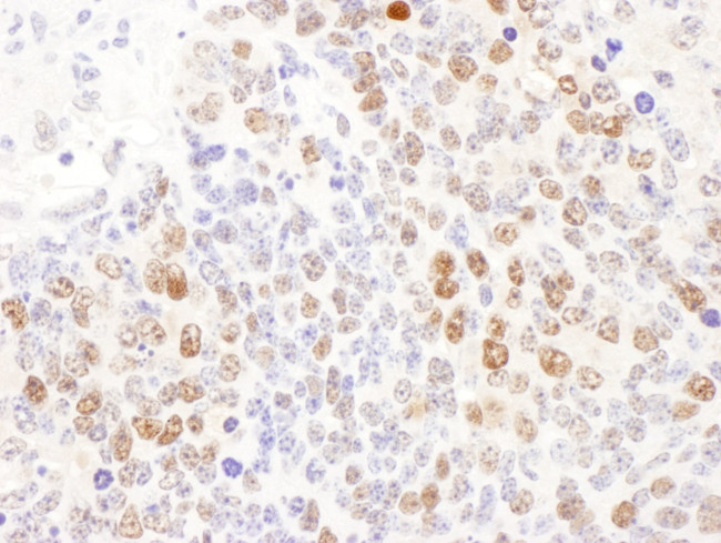 DCK Antibody in Immunohistochemistry (IHC)