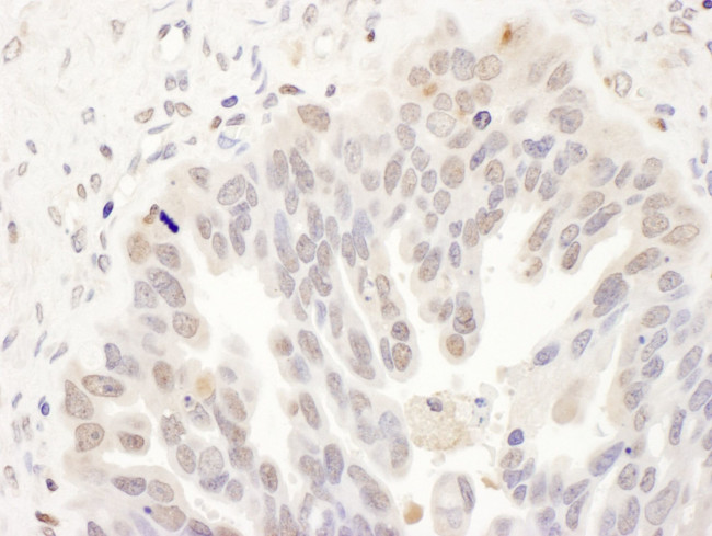 DCK Antibody in Immunohistochemistry (IHC)