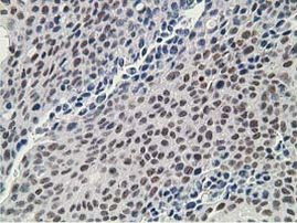 DCK Antibody in Immunohistochemistry (Paraffin) (IHC (P))