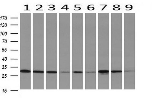 DCK Antibody in Western Blot (WB)