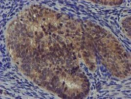 DCLRE1B Antibody in Immunohistochemistry (Paraffin) (IHC (P))