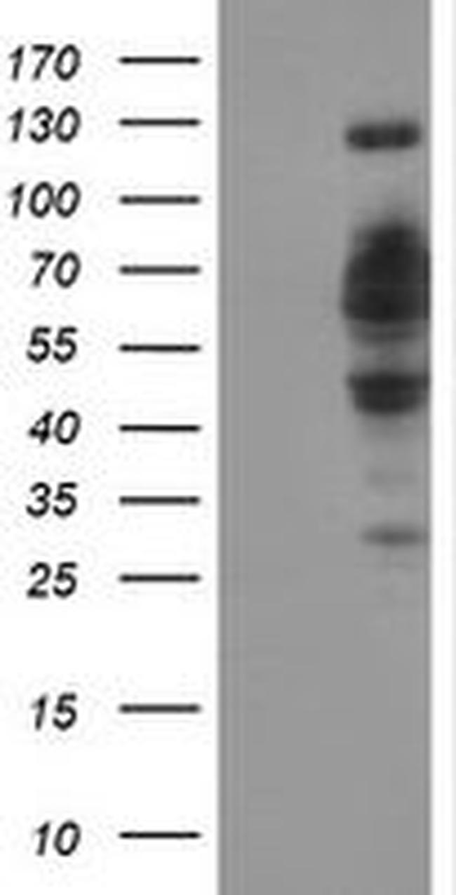 DCLRE1B Antibody in Western Blot (WB)