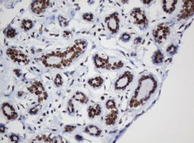 DCPS Antibody in Immunohistochemistry (Paraffin) (IHC (P))