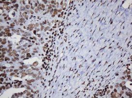 DCPS Antibody in Immunohistochemistry (Paraffin) (IHC (P))