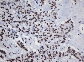 DCPS Antibody in Immunohistochemistry (Paraffin) (IHC (P))