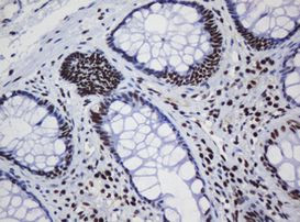 DCPS Antibody in Immunohistochemistry (Paraffin) (IHC (P))