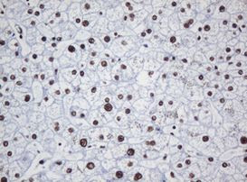 DCPS Antibody in Immunohistochemistry (Paraffin) (IHC (P))