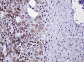 DCPS Antibody in Immunohistochemistry (Paraffin) (IHC (P))