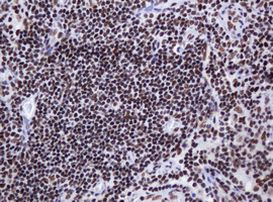 DCPS Antibody in Immunohistochemistry (Paraffin) (IHC (P))