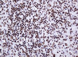 DCPS Antibody in Immunohistochemistry (Paraffin) (IHC (P))