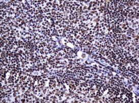 DCPS Antibody in Immunohistochemistry (Paraffin) (IHC (P))