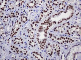 DCPS Antibody in Immunohistochemistry (Paraffin) (IHC (P))