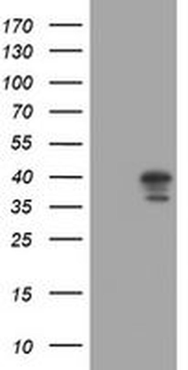 DCPS Antibody in Western Blot (WB)