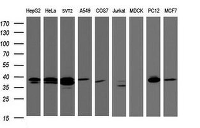 DCPS Antibody in Western Blot (WB)