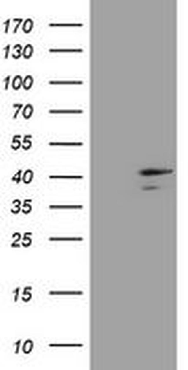 DCPS Antibody in Western Blot (WB)