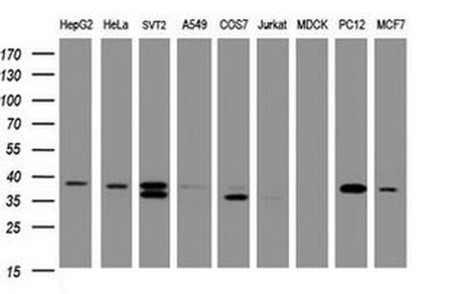 DCPS Antibody in Western Blot (WB)