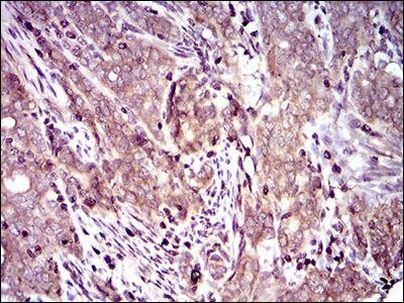 Dynactin 4 Antibody in Immunohistochemistry (Paraffin) (IHC (P))