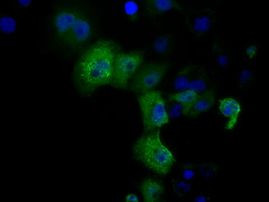 DCXR Antibody in Immunocytochemistry (ICC/IF)