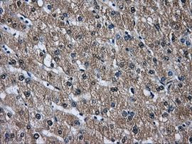 DCXR Antibody in Immunohistochemistry (Paraffin) (IHC (P))