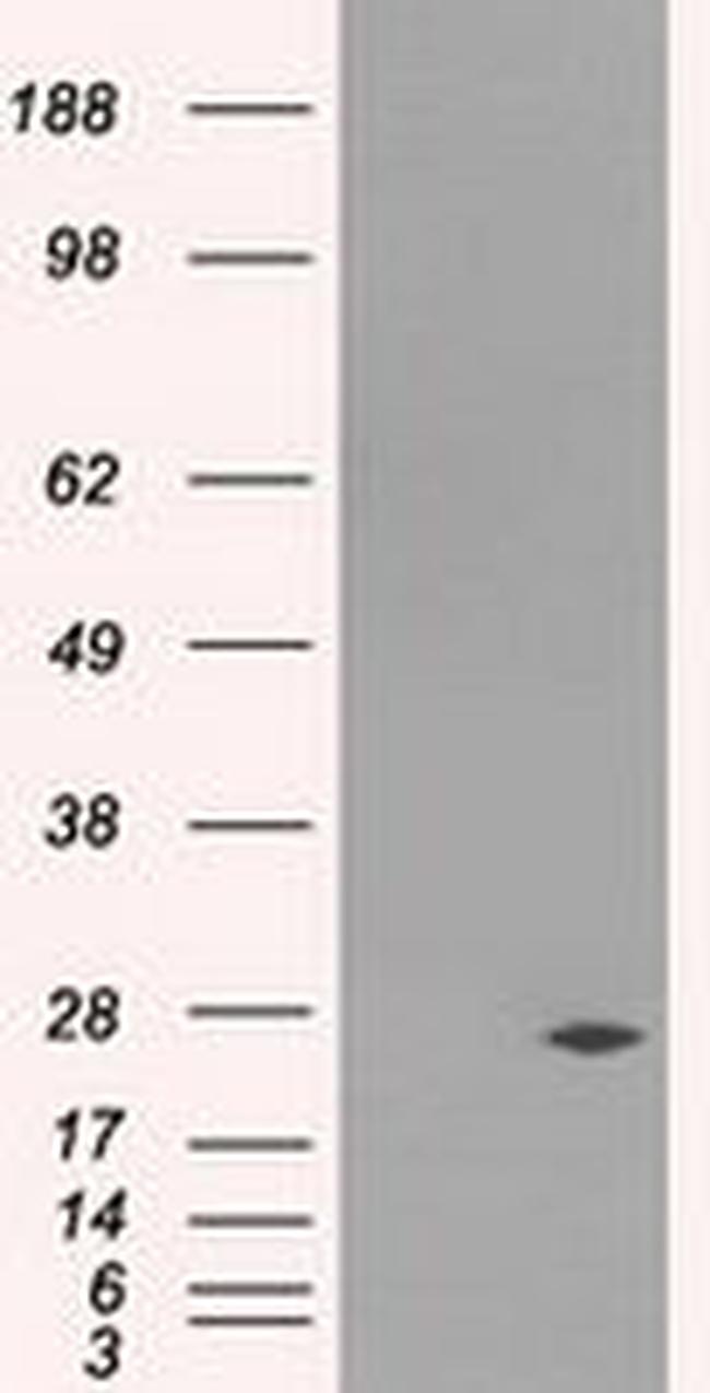 DCXR Antibody in Western Blot (WB)