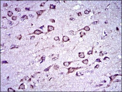 Doublecortin Antibody in Immunohistochemistry (Paraffin) (IHC (P))