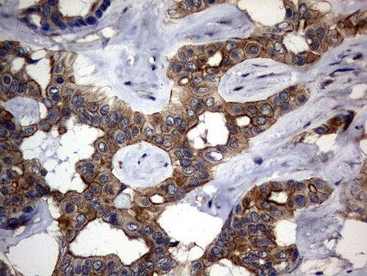 DDIT3 Antibody in Immunohistochemistry (Paraffin) (IHC (P))