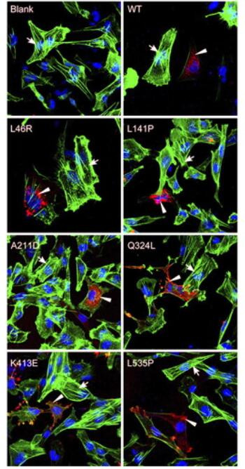 DDK Antibody in Immunocytochemistry (ICC/IF)