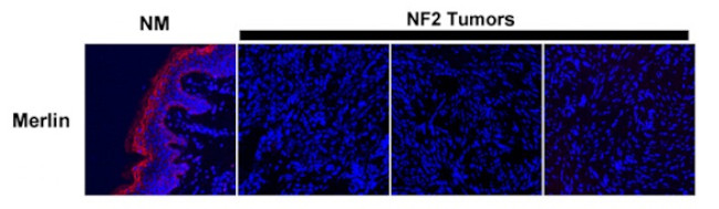 DDK Antibody in Immunohistochemistry (IHC)