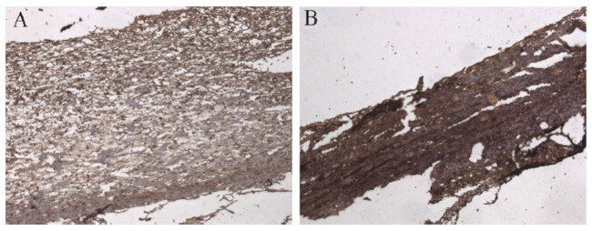 DDK Antibody in Immunohistochemistry (IHC)