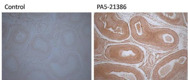 DDT Antibody in Immunohistochemistry (IHC)