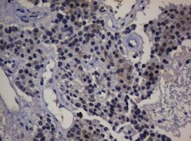 DDT Antibody in Immunohistochemistry (Paraffin) (IHC (P))