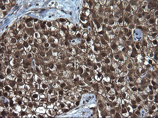 DDT Antibody in Immunohistochemistry (Paraffin) (IHC (P))