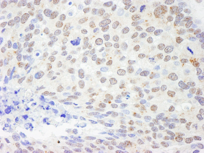 DDX1 Antibody in Immunohistochemistry (IHC)