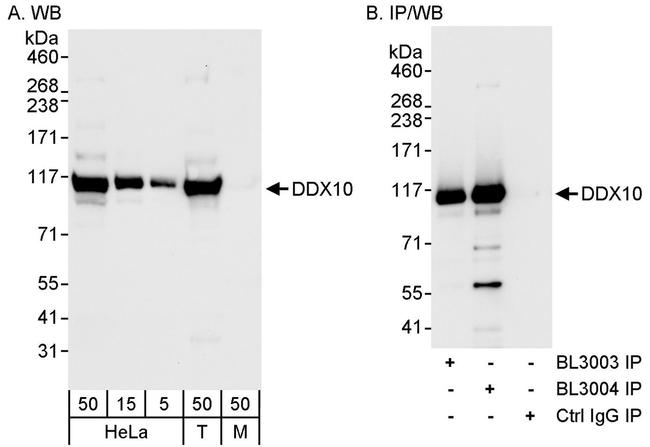 DDX10 Antibody in Western Blot (WB)