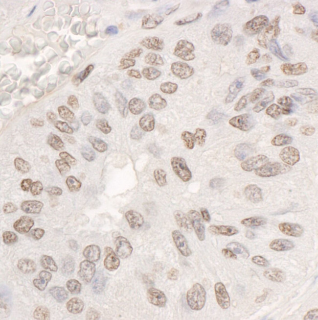 DDX17 Antibody in Immunohistochemistry (IHC)