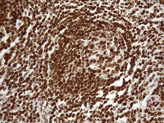 DDX19A Antibody in Immunohistochemistry (Paraffin) (IHC (P))