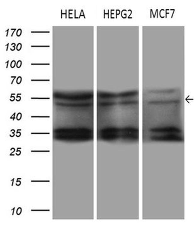 DDX19A Antibody in Western Blot (WB)