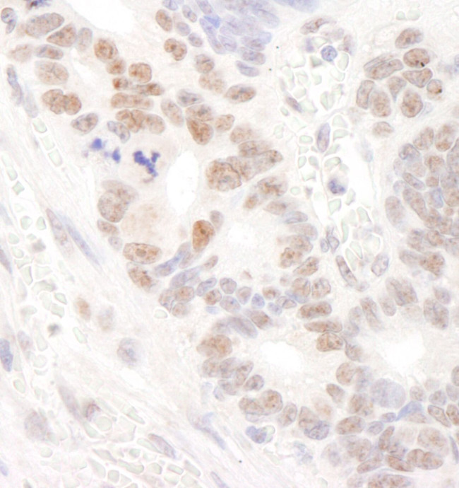 DDX24 Antibody in Immunohistochemistry (IHC)