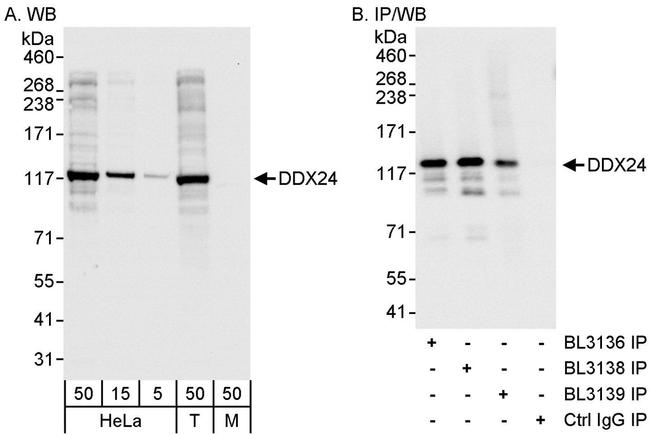 DDX24 Antibody in Western Blot (WB)